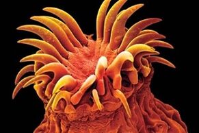 الطفيليات تريماتودا في البشر