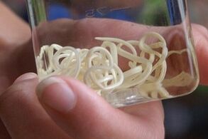 الطفيليات في جسم الإنسان