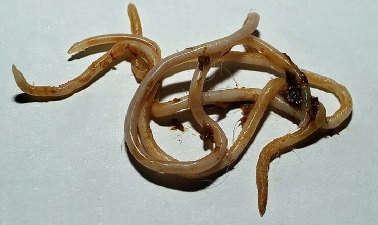 التوكسوكارا في جسم الإنسان